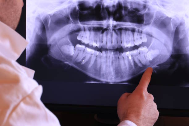 Best Emergency Gum Treatment in Menands, NY