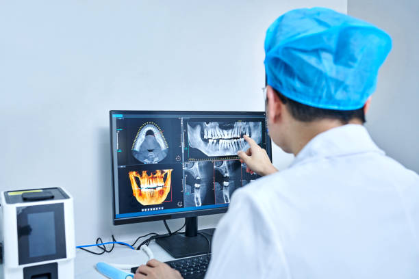 Best Emergency Dental Care for Broken or Chipped Teeth in Menands, NY